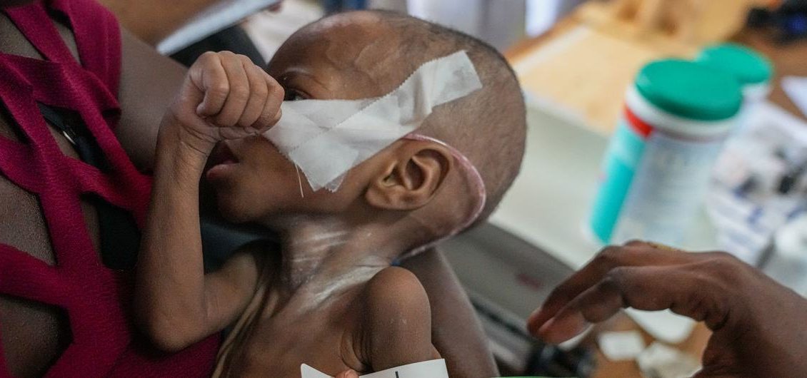 منظمة الصحة العالمية تطلق نداء